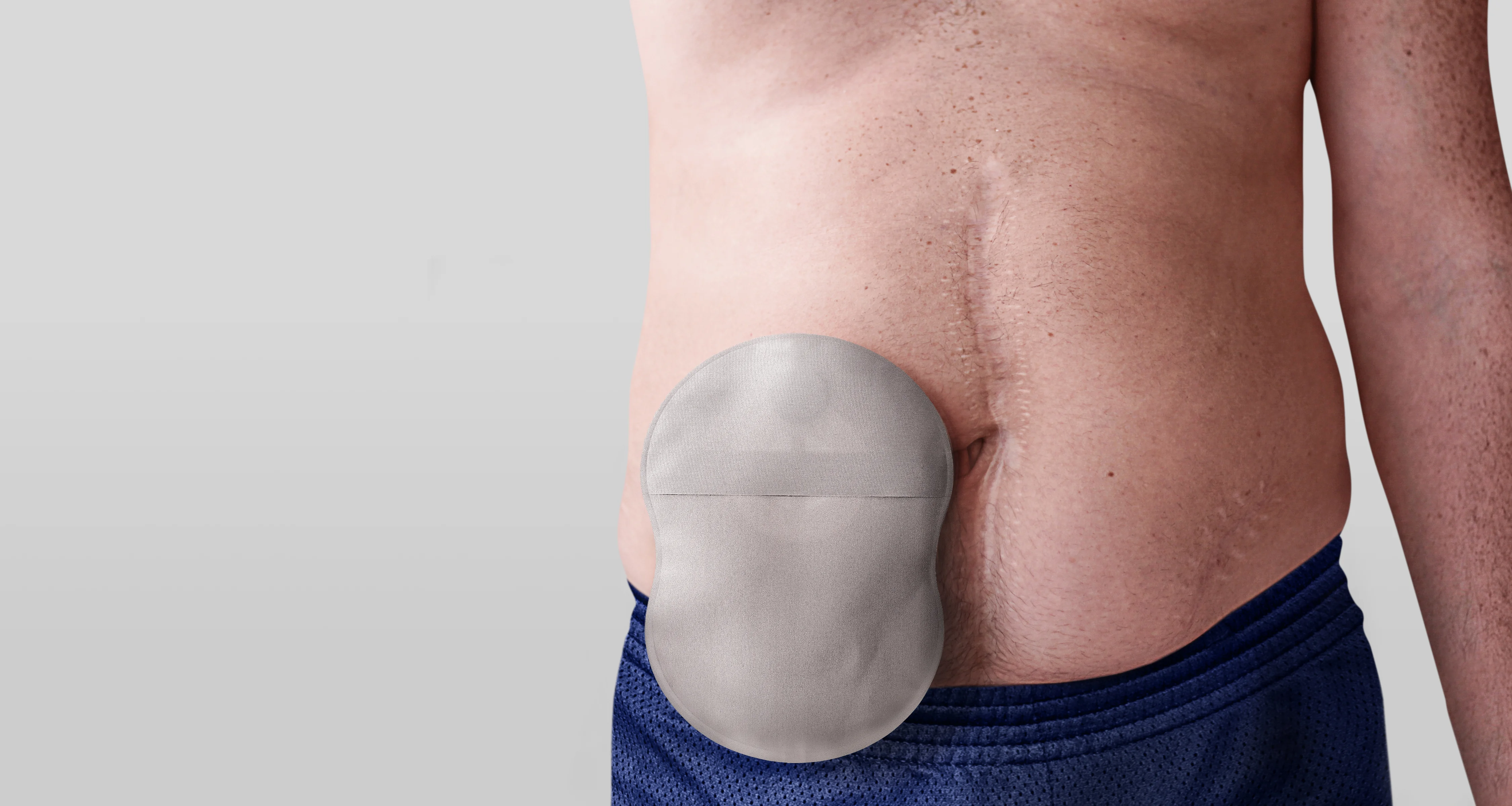Hombre con una bolsa de ostomía Esteem Body™